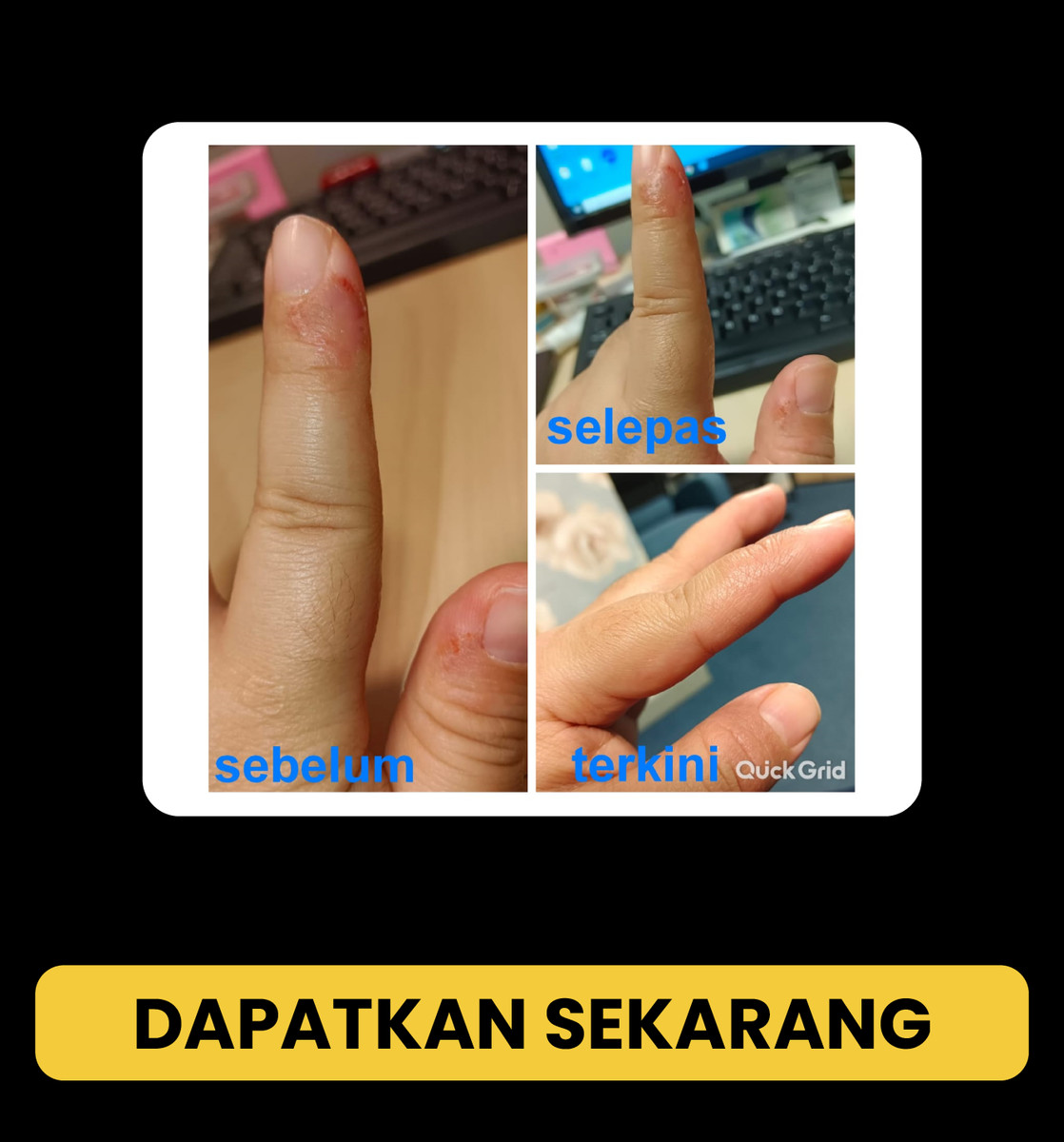 Testimoni BlackFusion 05 — Gambar sebelum dan selepas yang dikongsi pada halaman asal